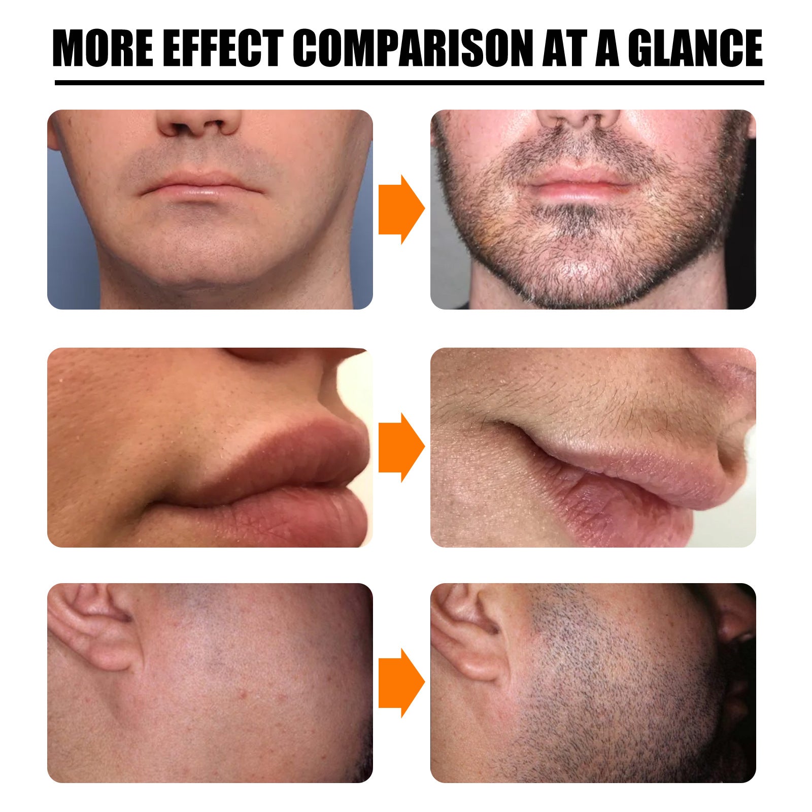 Nourishing Beard Growth Spray Set