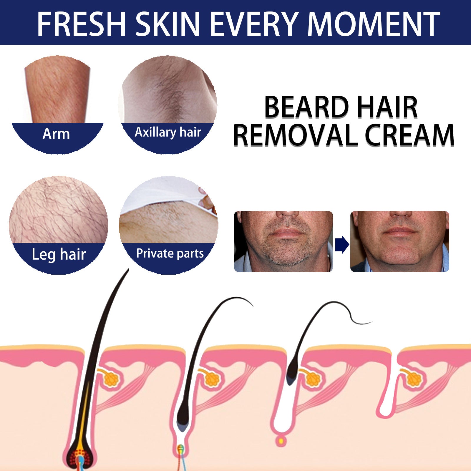 Men's Hair Removal Cream